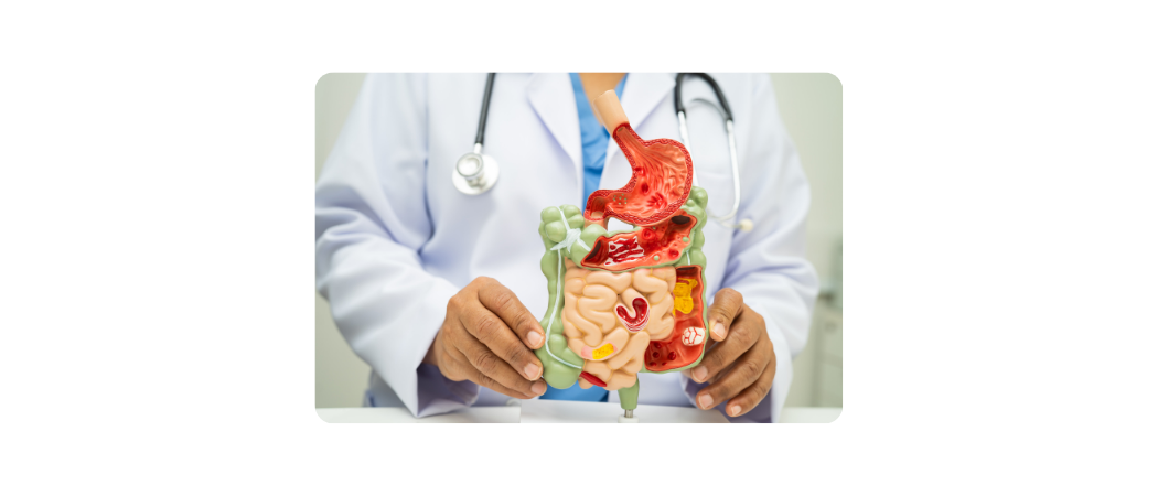 Ramazan'da bağırsak sağlığı için en kötü gıdalar neler?