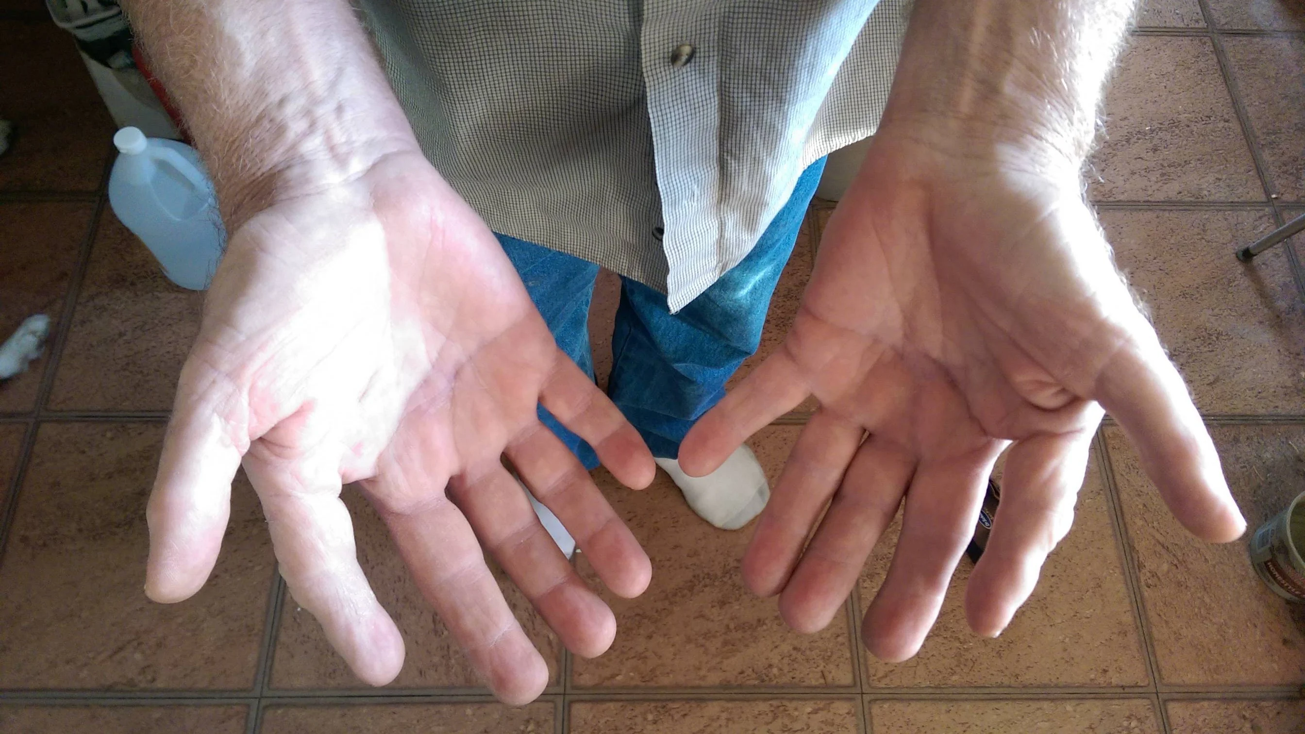 Rüyada Altı Parmak Görmek