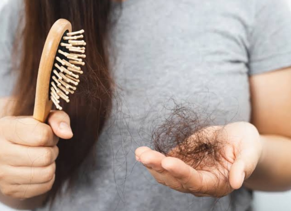 Saç Dökülmesi